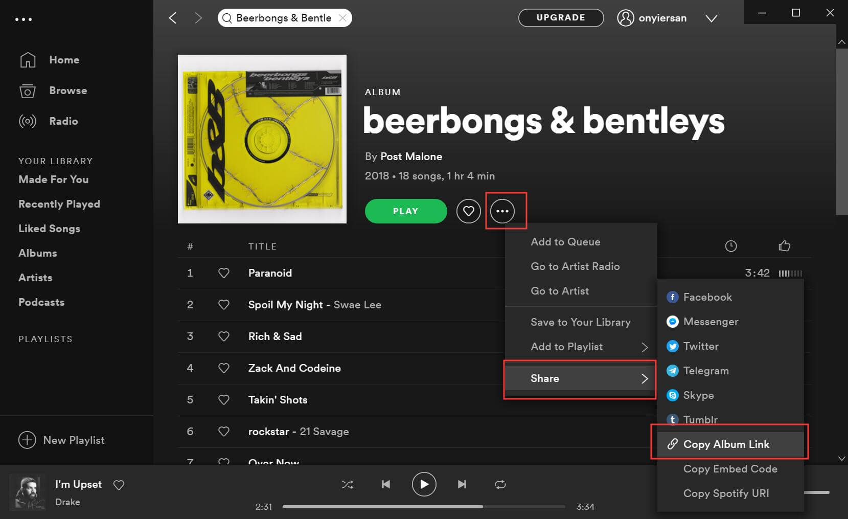 cảnh sát Beerbongs & B Bentley